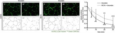 PETN-Induced Antioxidative Properties in Endothelial Cells as a Target for Secondary Prevention of Endothelial Dysfunction in Pregnancy